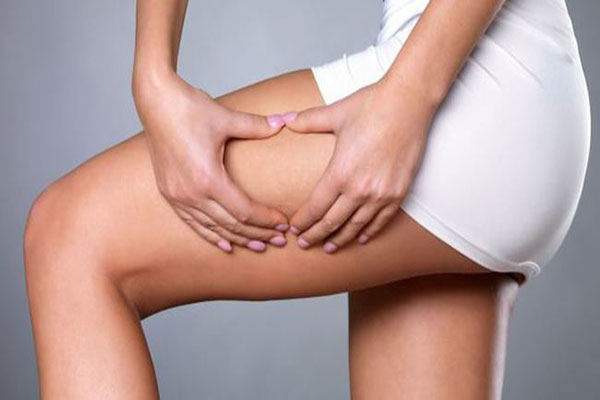 Stretch Mark Treatment